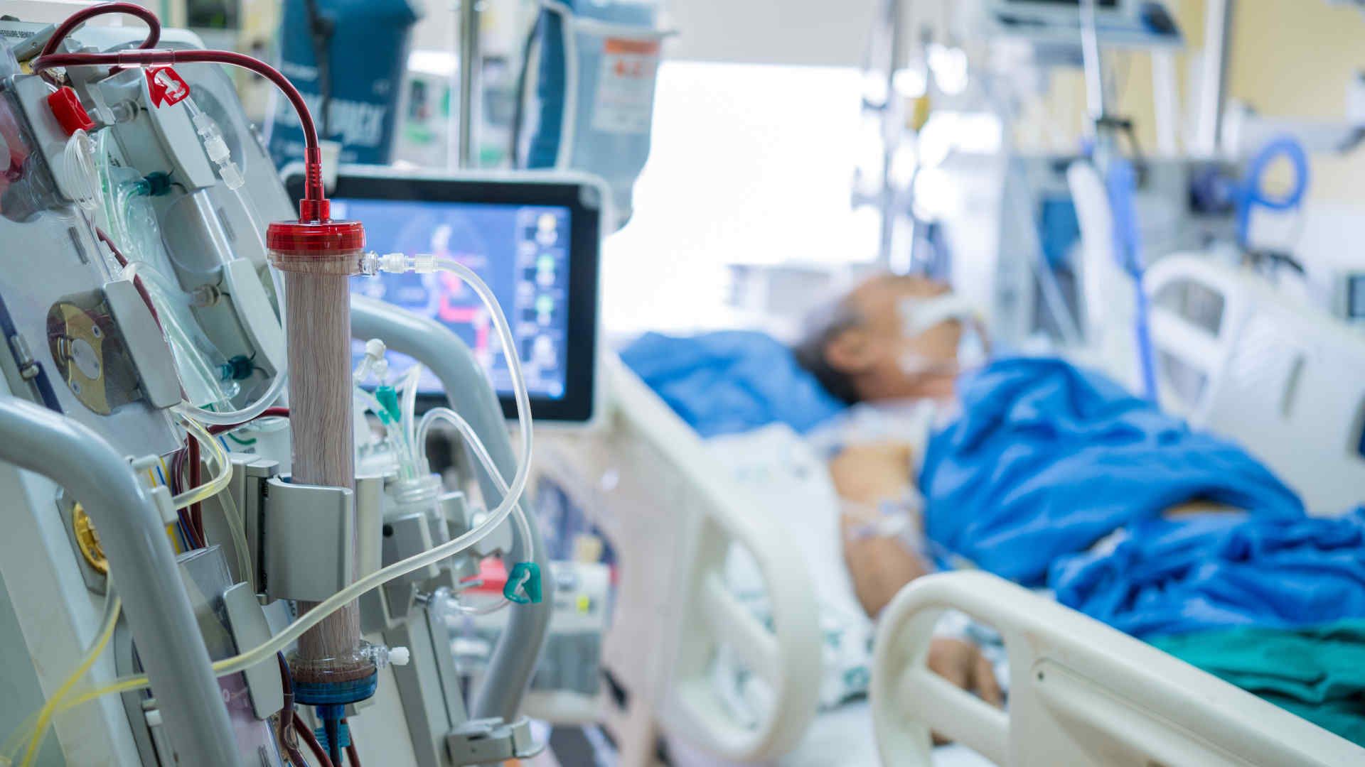 Ventilated ICU patient on dialysis