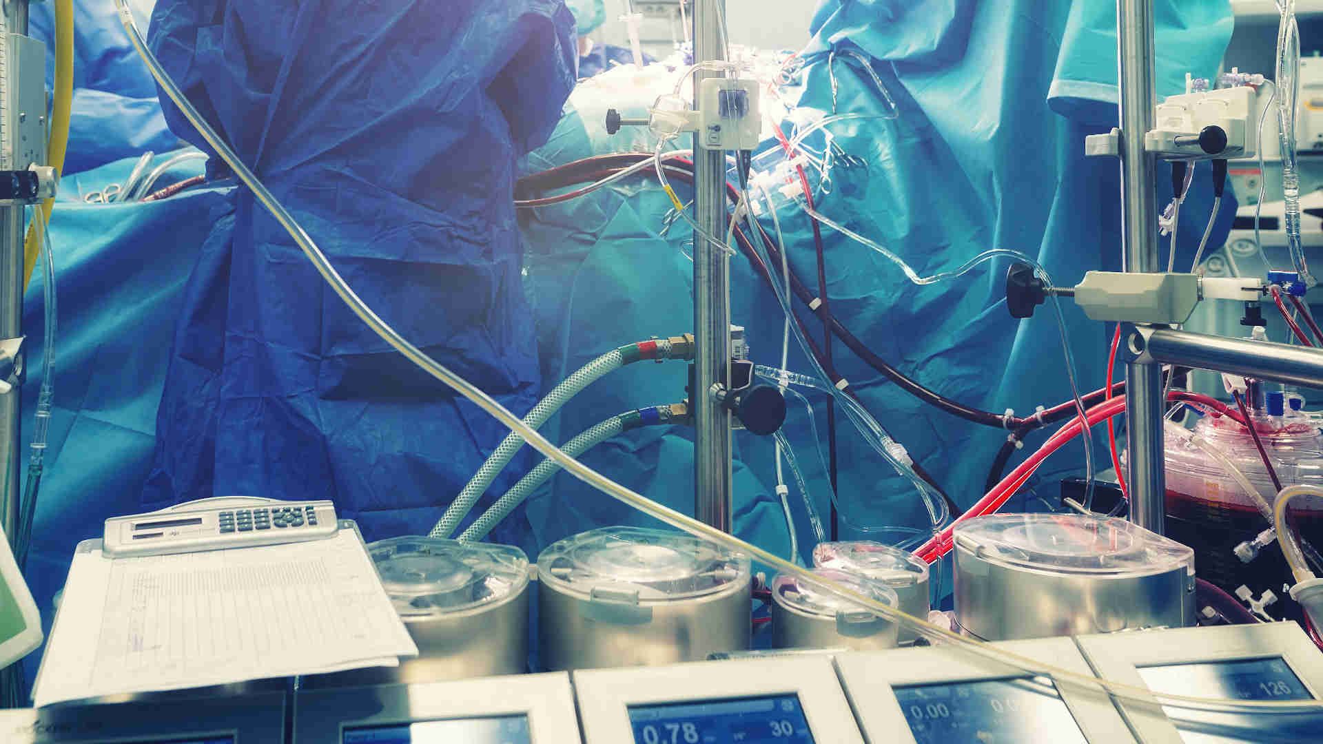 Cardiopulmonary bypass machine