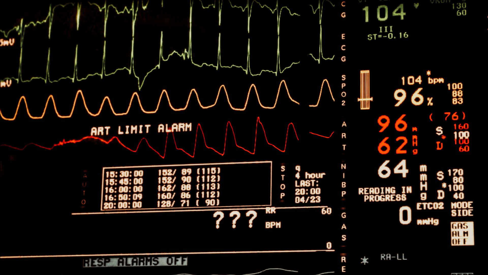Bedside ICU monitor