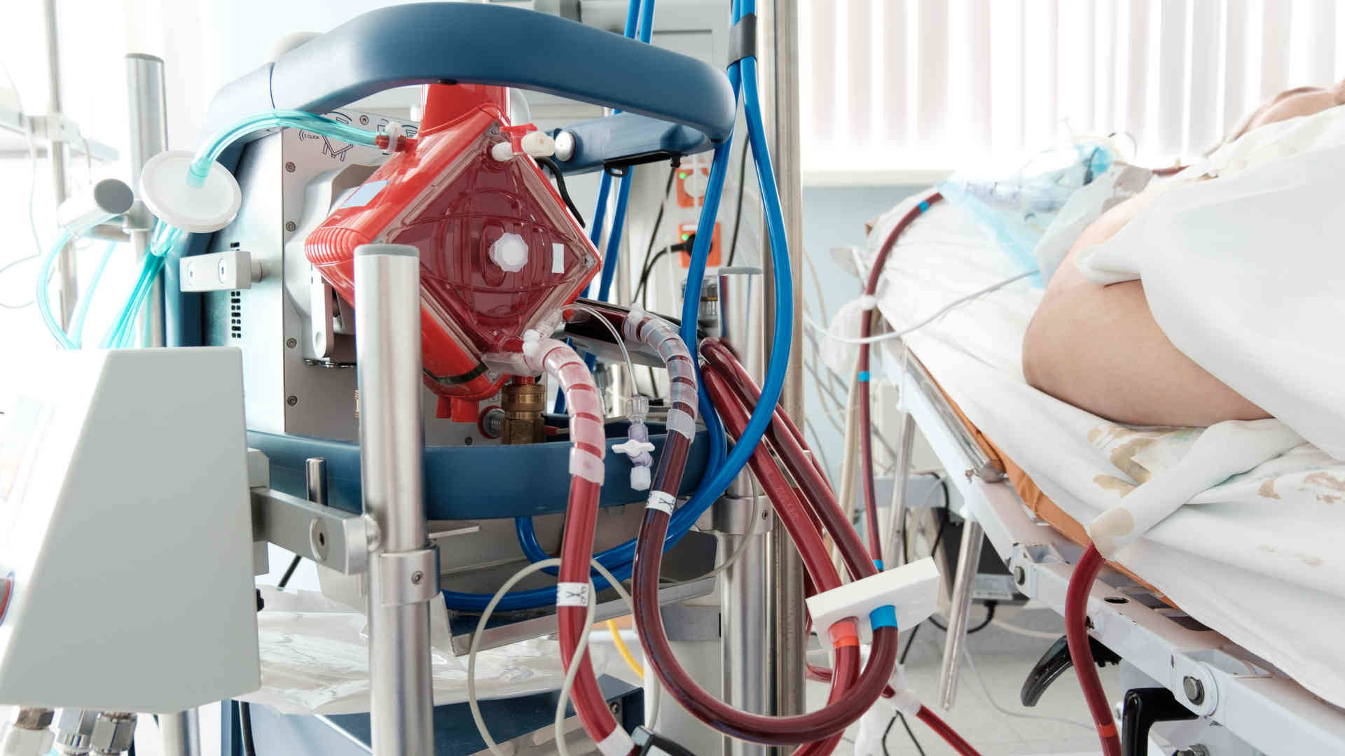 ECMO machine beside a patient in the ICU