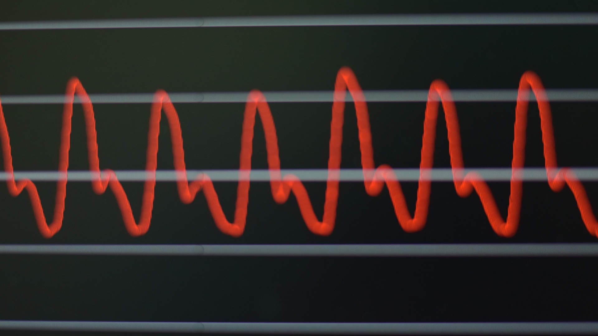 Bedside critical care monitor
