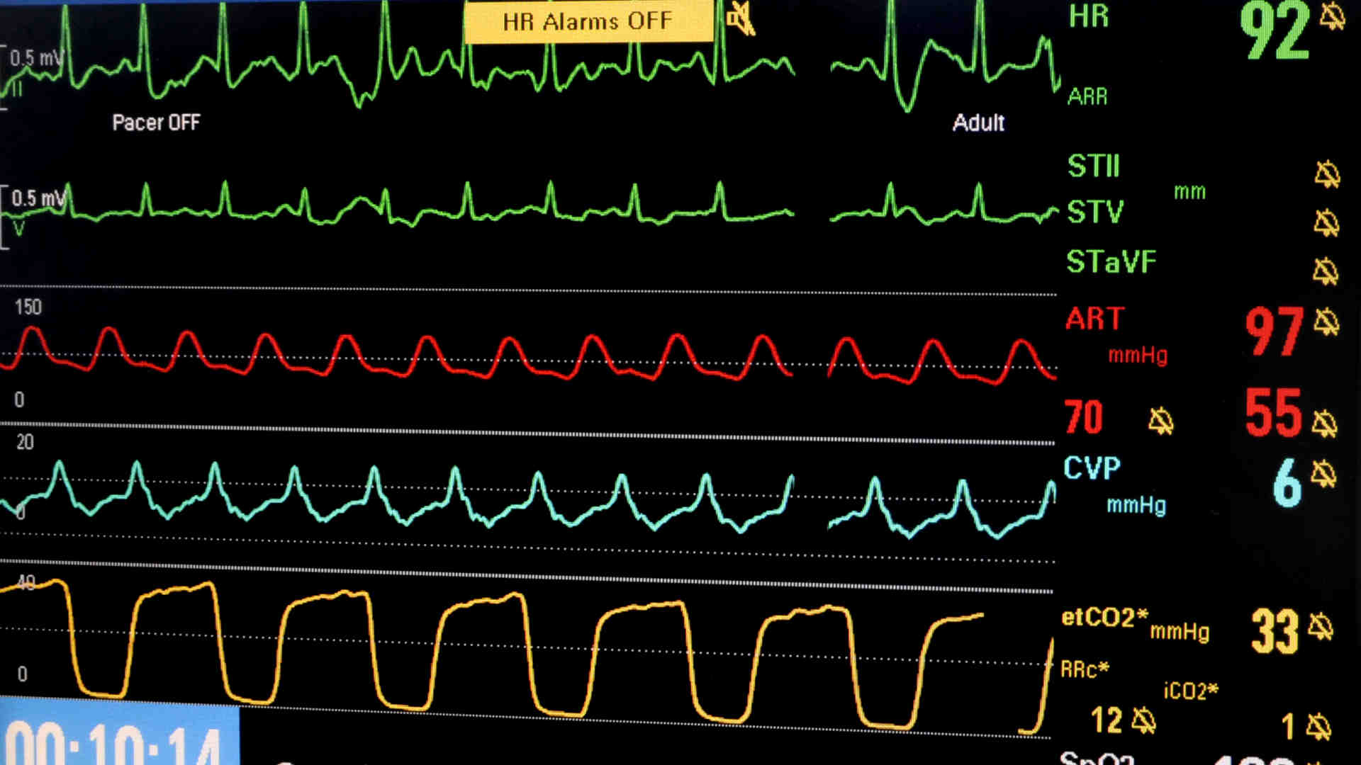 Bedside critical care monitor