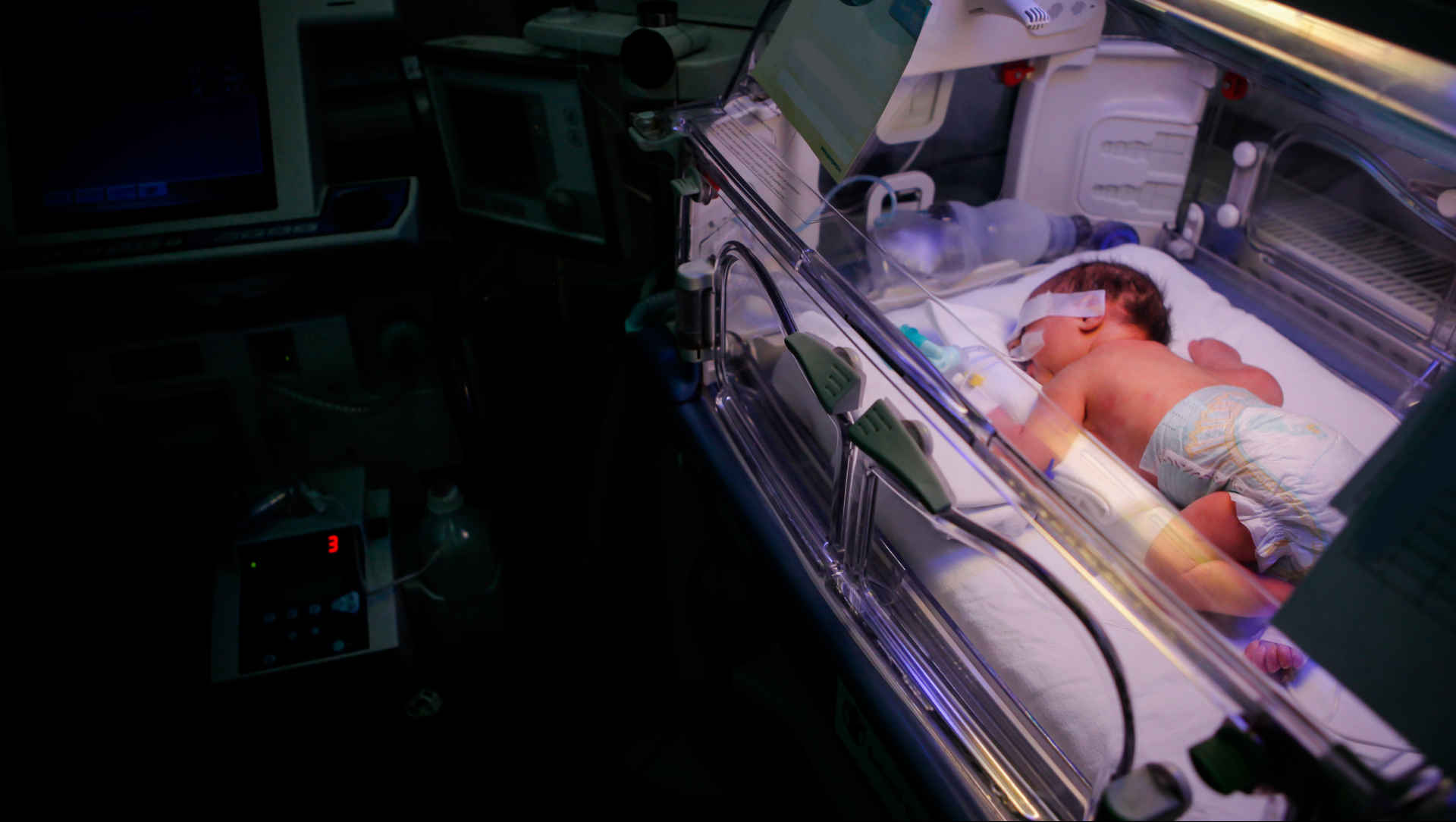 Premature infant in the NICU