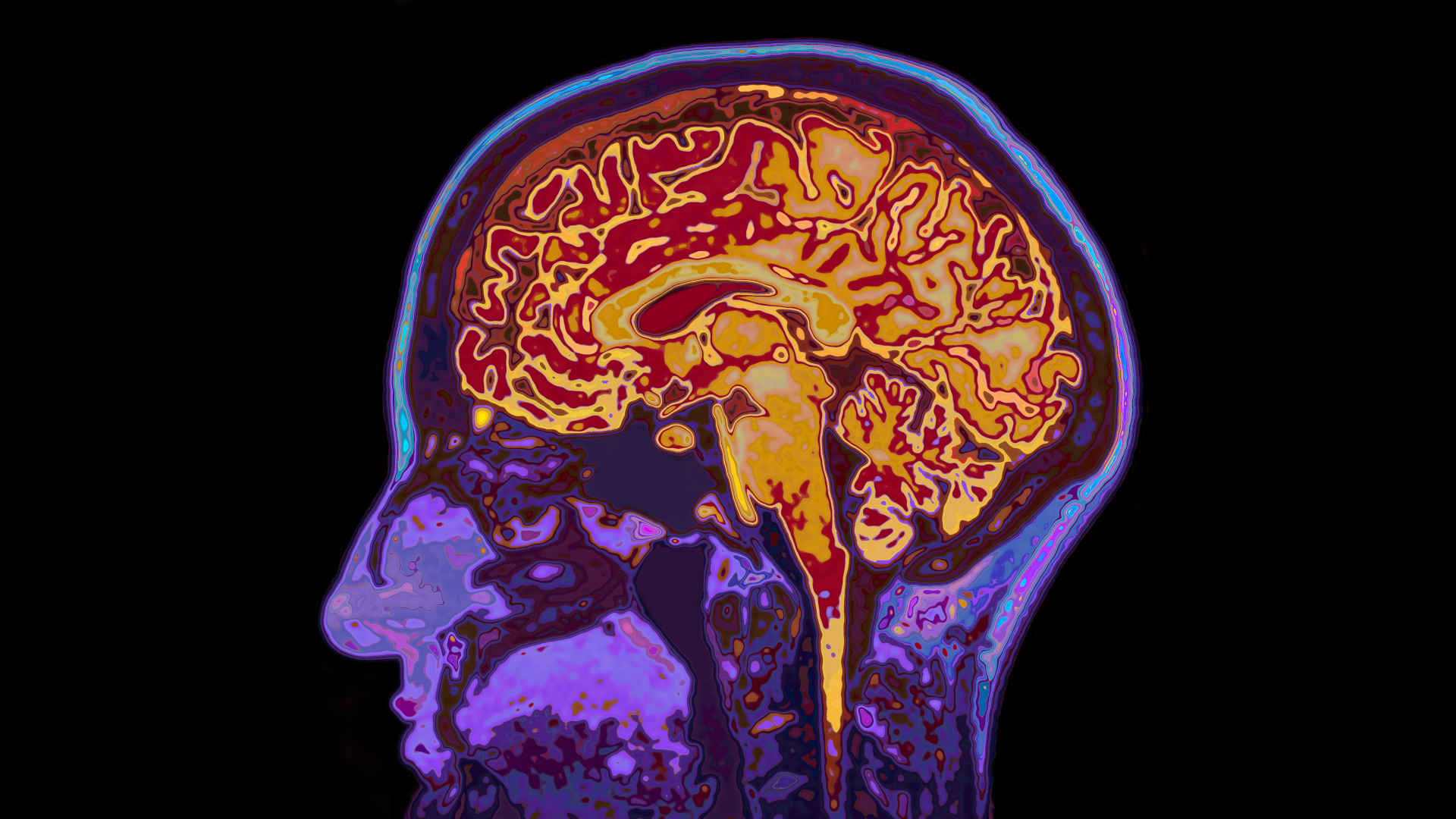 Coloured saggital section of the brain