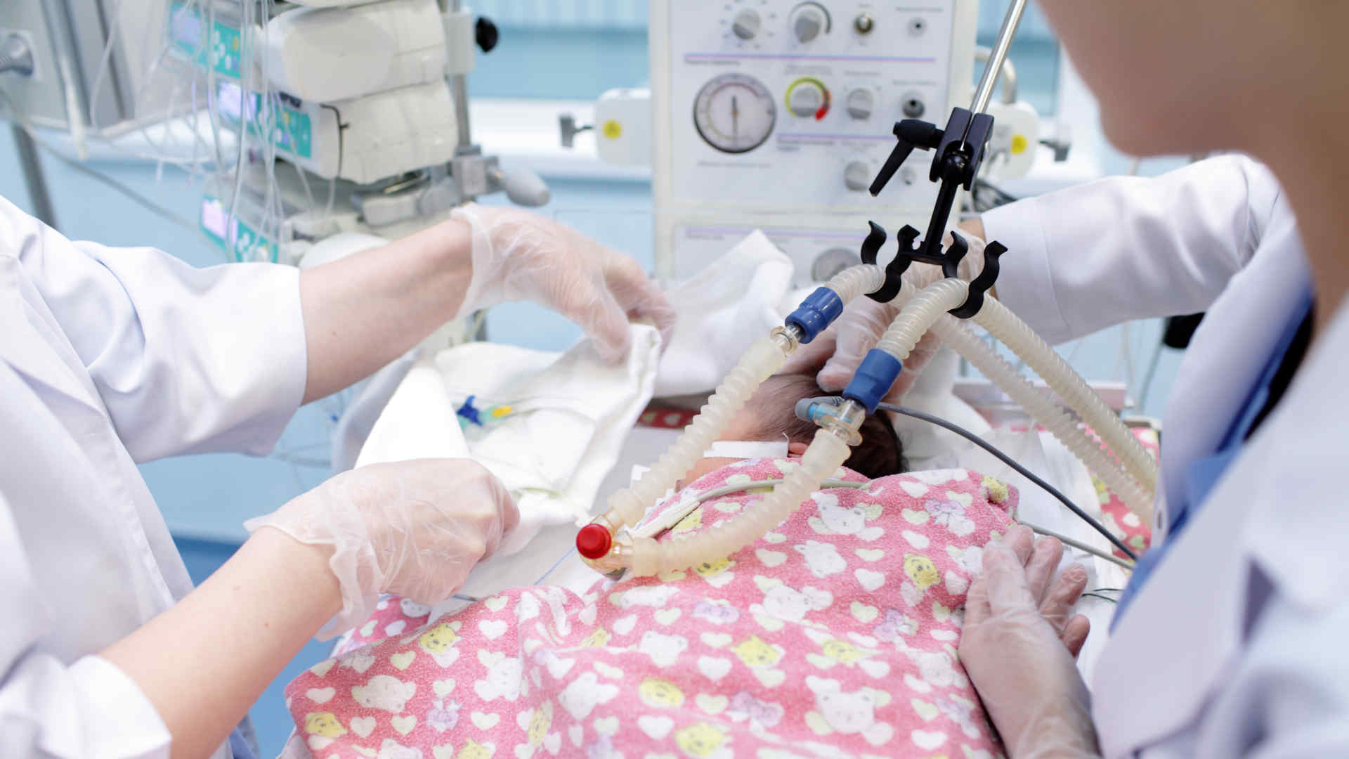 Ventilated paediatric patient in the PICU