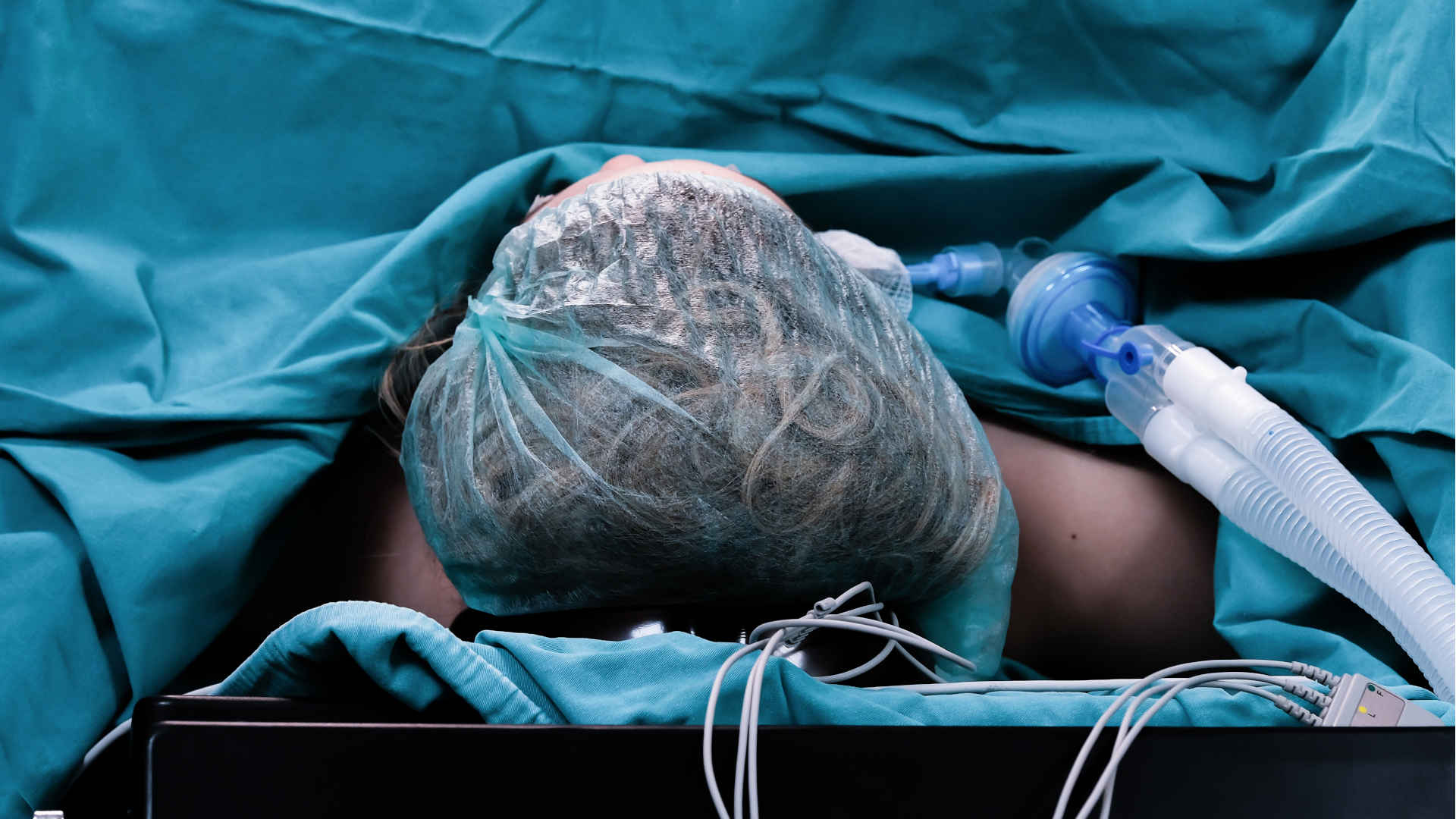 Intubated patient undergoing surgery