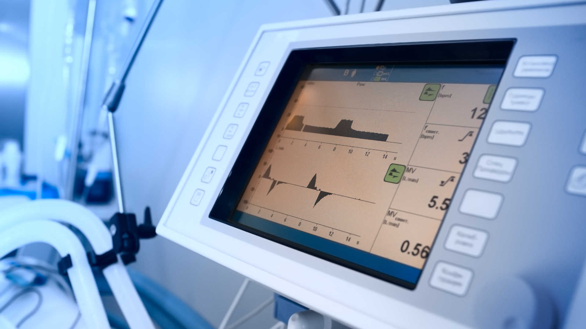 Screen of an ICU ventilator