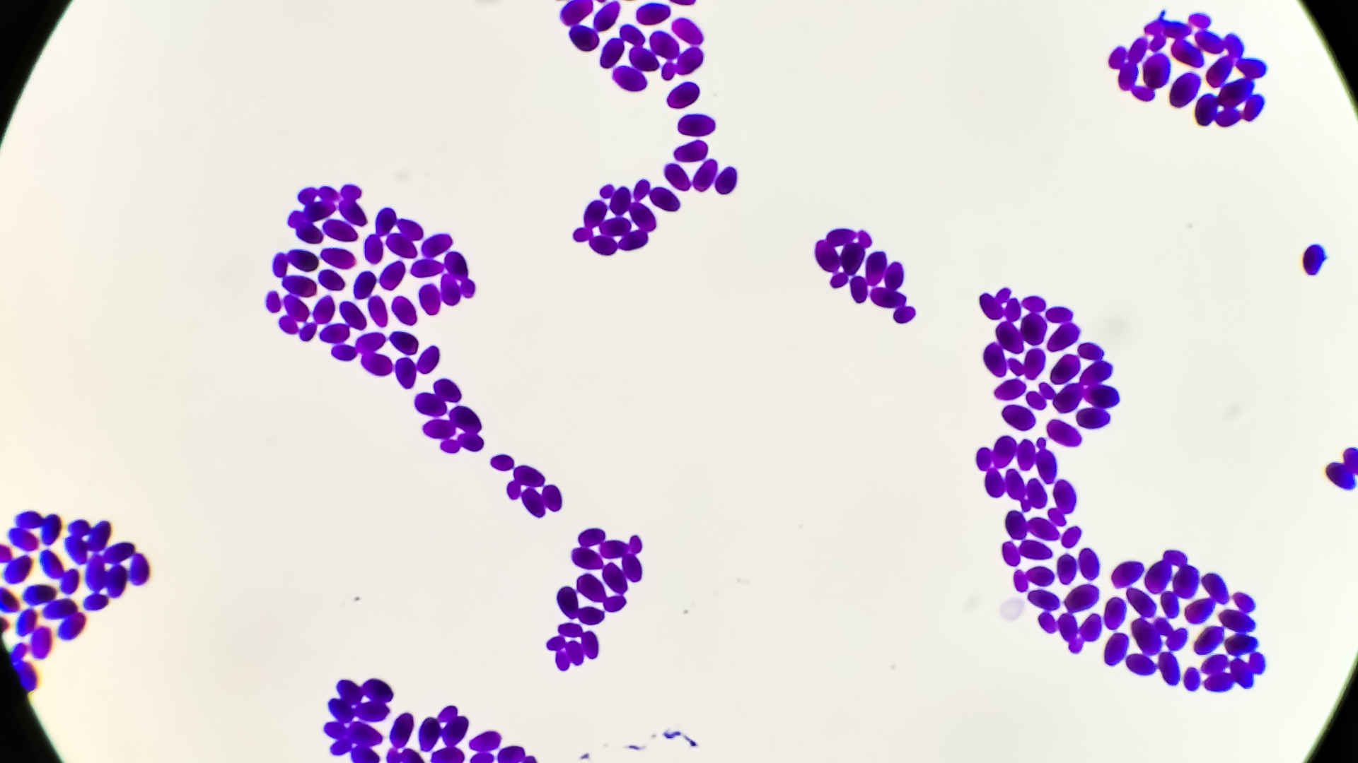 Candida albicans culture