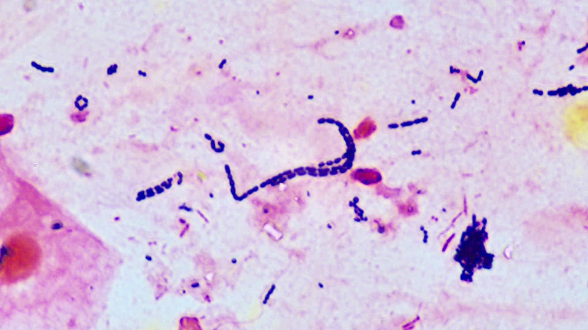 Streptococci in chains