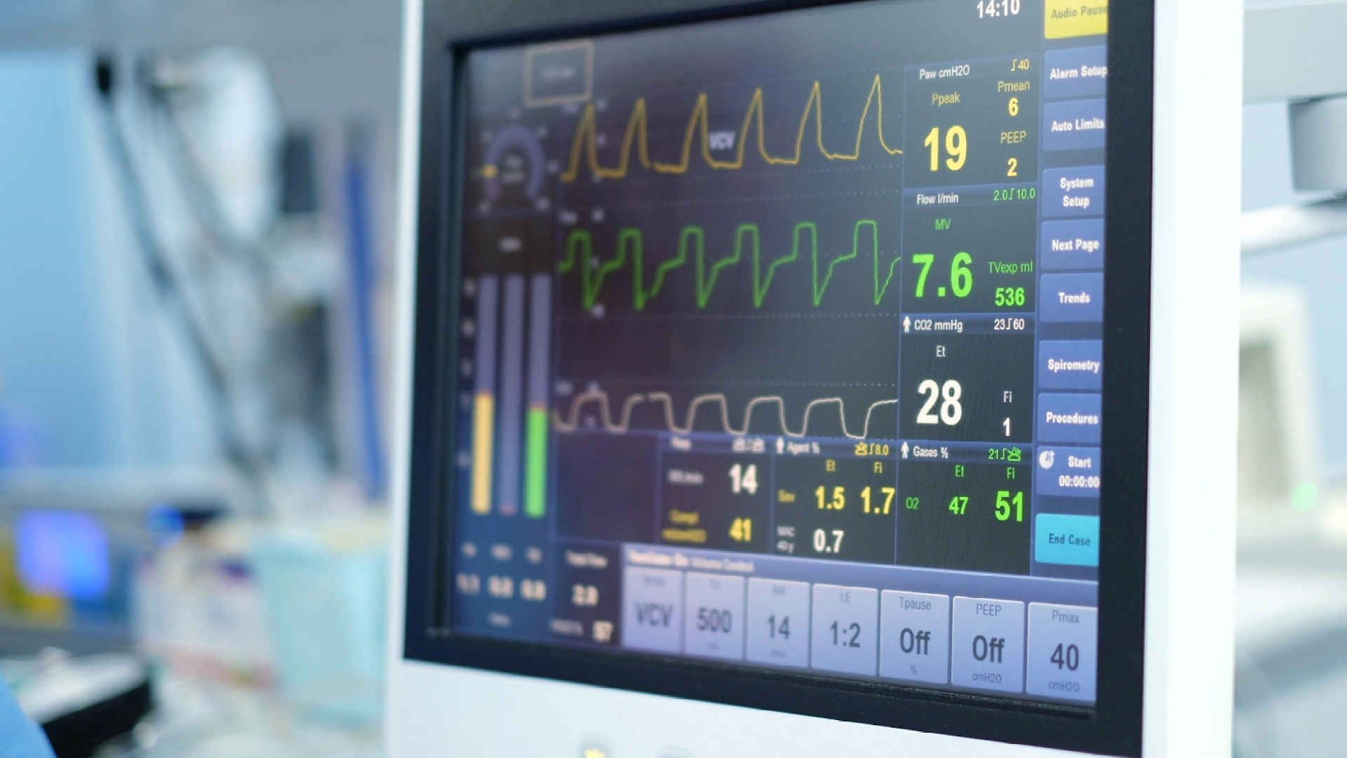 Mechanical ventilator console
